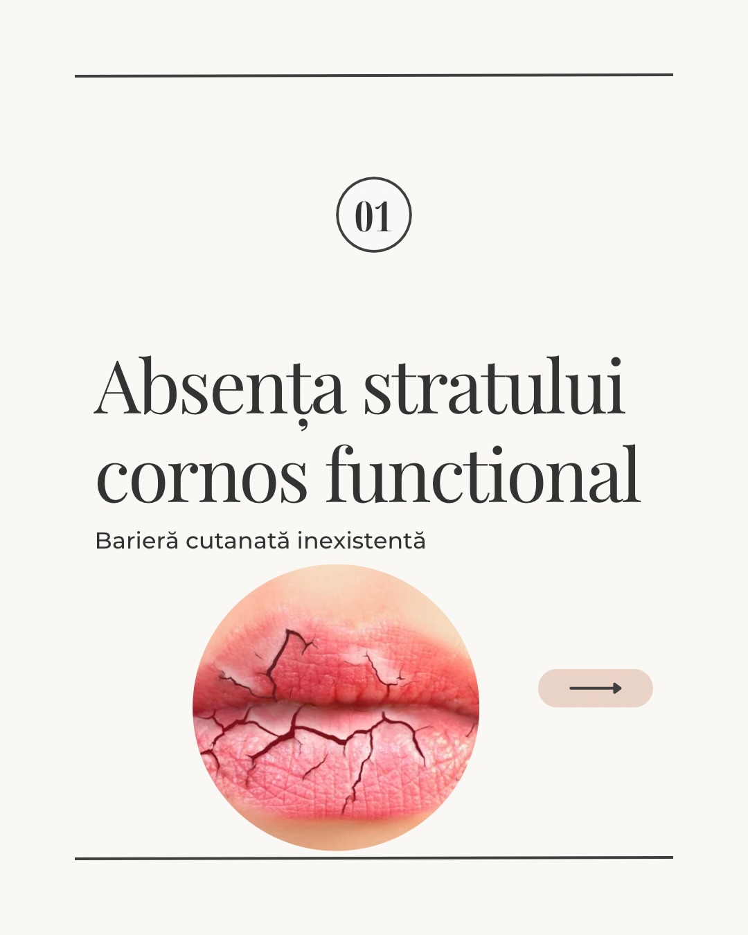 Absența Stratului Cornos