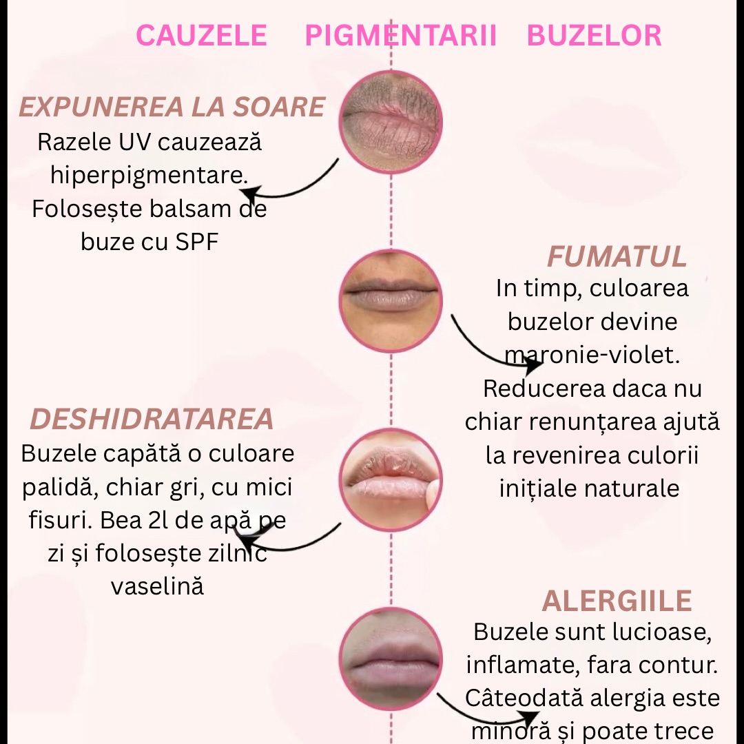Cauzele Pigmentării Buzelor