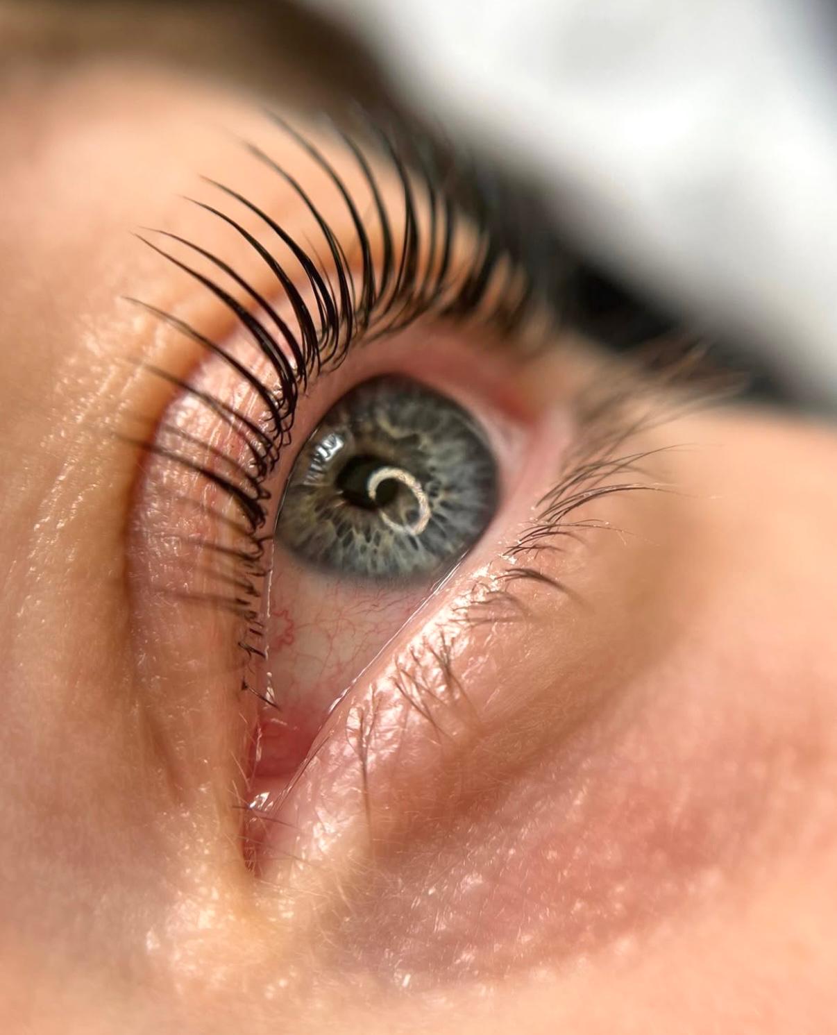 Lash lift – gene curbate